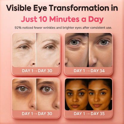 LumiLift™ Eye Therapy Mask